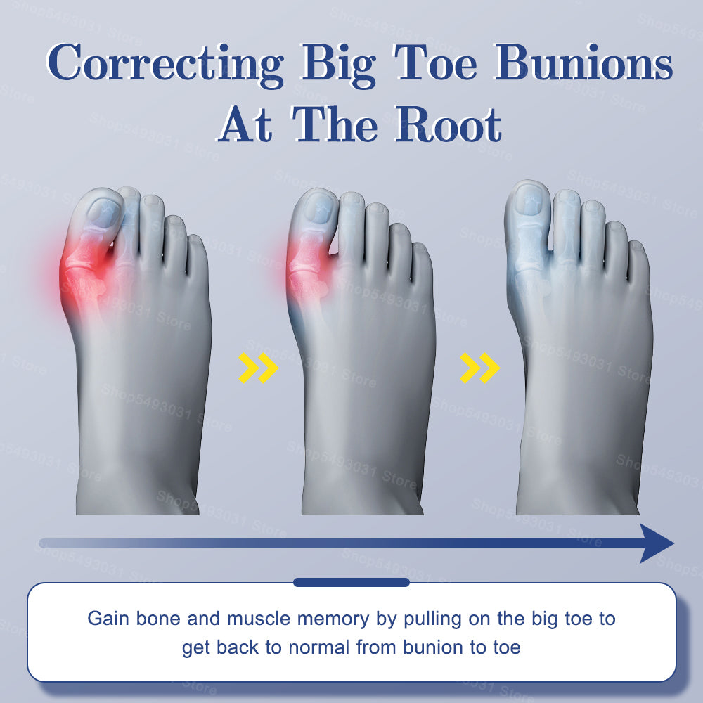 Premium Adjustable Bunion Corrector - Hallux Valgus Toe Straightener with Orthopedic Splint, Rotatable Toe Separator for Pain